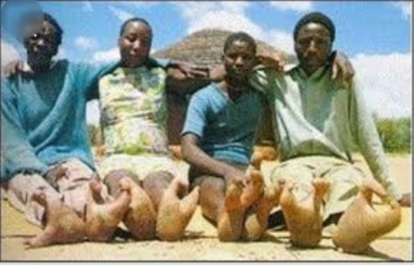 Doma Tribe in Africa with Alien Legs (Ostrich Legs)