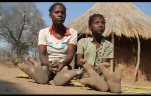  Doma Tribe in Africa with Alien Legs (Ostrich Legs) - Photos