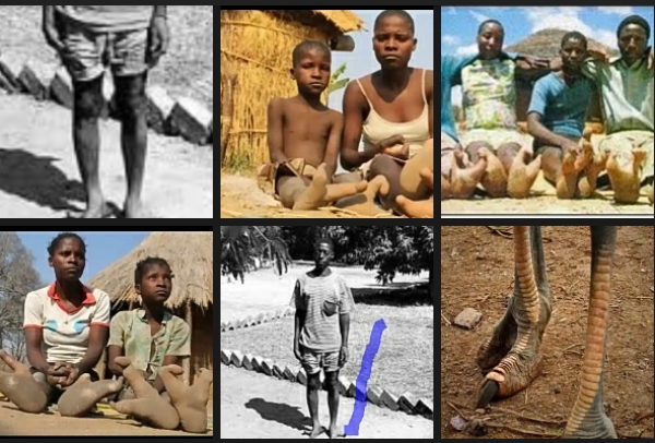 Doma Tribe in Africa with Alien Legs (Ostrich Legs)