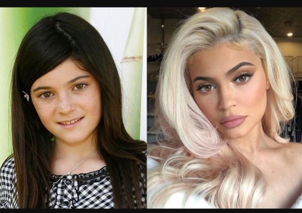  Kylie Kardashian in her Teenage before her Transformation - Photos.