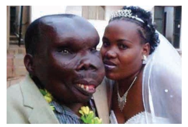 Godfrey Baguma in 2022 - The Ugliest Man In World